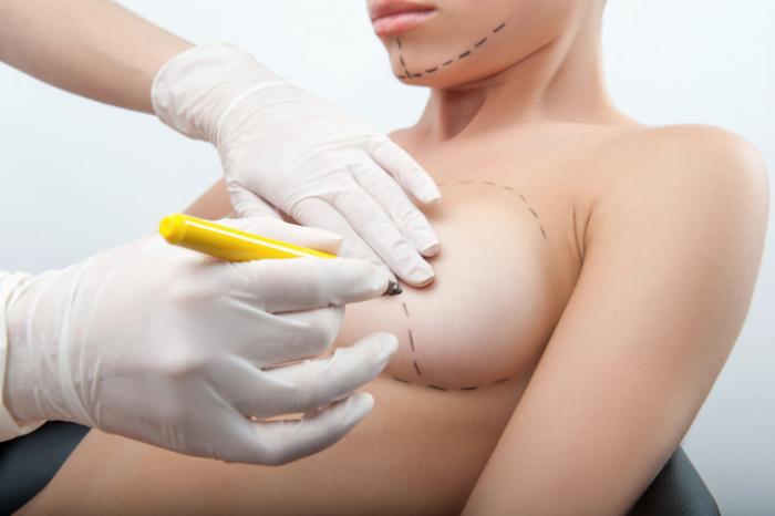 Breast Augmentation in Vancouver