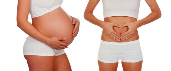 Cirugía estética de abdomen después del embarazo