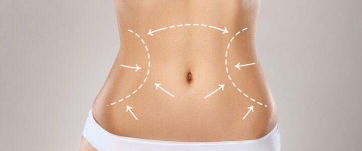 Abdominoplasty Colombia : Complete Guide to Successful Surgery